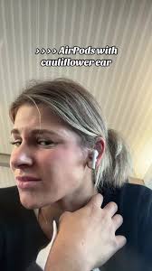 AirPods and Cauliflower Ear: Comfort Concerns Explained