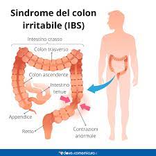Come prevenire la sindrome del colon irritabile. Sindrome Del Colon Irritabile Ibs Cos E Cause Cosa Mangiare