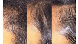 Light shampoo for your scalp cleansing and light peppermint oil for extra care are going to be the most important items in your list of care products, but finally you will be able to. 4 Tips To Make Your Edge Control More Effective Black Hair Information Edges Hair Relaxed Hair Hair Styles