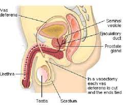 You come to see us for a consultation at which i explain the procedure and answer your questions. Vasectomy The Private Clinic Surry Hills