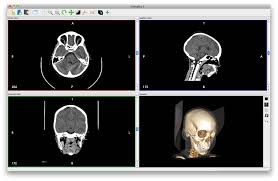 Check spelling or type a new query. Top 12 Free Open Source Dicom Viewers And Pacs Workstations For Macos