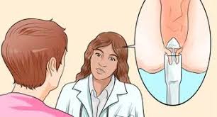 How to get rid of hemorrhoids reddit. 4 Ways To Get Rid Of Hemorrhoids Naturally Wikihow
