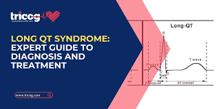 Image result for QT Interval