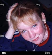 Post mortem showed hi-res stock photography and images