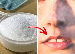Cosmetic treatments prepare a paste of one egg white, one tablespoon of sugar and half a tablespoon of corn flour. 9 Simple Ingredients To Get Rid Of Facial Hair At Home