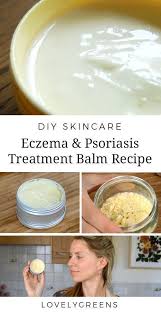 Baume A La Main Pour L Eczema Et Le Psoriasis Yag Dogal Krem