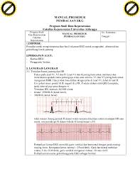 12 sadapan ekg berkualitas diagnostik dikalibrasikan sebesar 10 mm/mv, jadi 1 mm sama dengan 0,1 mv. Pdf Manual Prosedurpembacaan Ekg Rchmad Aziz Academia Edu