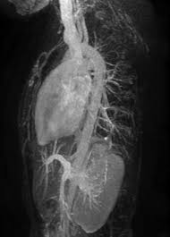 Image result for Cardiac MRI