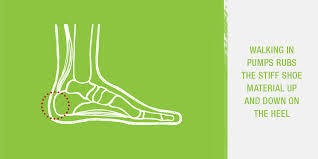 This condition is often precipitated by wearing shoes with rigid backs that rub against the heel. Haglund Deformity Explained Superfeet Superfeet