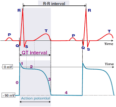 Image result for QT Interval