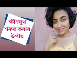 How To Get Chubby Cheeks