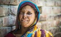 Acid attacks | ActionAid UK