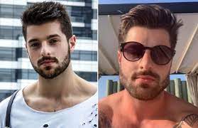 Harmonização facial, botox, lipo lad, preenchimento, rinoplastia e muitos outros procedimentos estéticos estão na lista dos mais solicitados. Harmonizacao Facial Saiba Como Funciona O Procedimento Que Virou Febre Entre Famosos