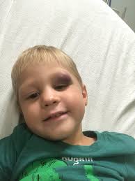 Just witnessed a ten seater hitting a little boy at the Kamkumung crossing.  Trangu head blem smash. Hit and run