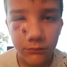 Boy, 11, tried to kill himself after being beaten with metal pole by cruel  bullies