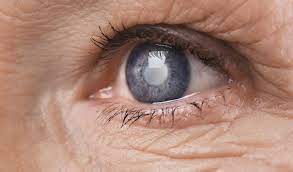 Pin On Eye Care In Buffalo Ny