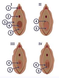 كيف أعرف أنها ما زالت عذراء؟ - الحب ثقافة