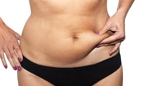 Will i need more than one procedure? Tummy Tuck Or Liposuction American Society Of Plastic Surgeons