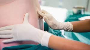 Image result for Active Labor Anesthesia