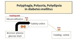 Image result for Polyuria