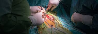 Look through examples of acvb translation in sentences, listen to pronunciation and learn grammar. Bei Schlechter Pumpfunktion Ist Ein Bypass Offenbar Besser Als Der Stent Medical Tribune