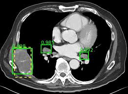 This provides a series of images from many different angles. Nih Issues Huge Database Of Ct Scans For Ai Testing Physics World