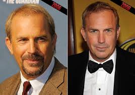 We did not find results for: Famous Celebrity Hair Transplants Ak Clinics