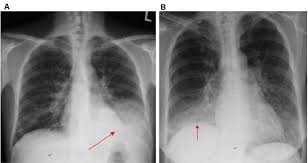 Image result for Silhouette Sign