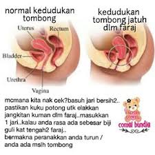 Itu sebabnya, kenapa oli keluar dari saringan udara pada sepeda motor, dan mungkin itu saja yang bisa hargaindo.com sampaikan kali ini terkait pembahasan mengenai penyebab oli keluar dari selang pernafasan mesin, semoga ulasan ini bisa sangat membantu dan bermanfaat untuk sobat sekalian. Rahsia Herba Bidan Melayu Indonesia Punca Dan Rawatan Tombong Prolapsekekenduran Rahim Prolapse Tombong