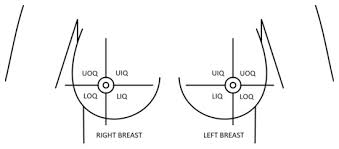 Naming the quadrants for the purpose of describing a lump  or 1. Sensors Free Full Text A Regression Model For Predicting Shape Deformation After Breast Conserving Surgery Html