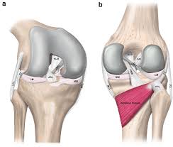 The anterior cruciate ligament prevents the femur from. Schematic Illustration Of The Anatomy Of The Posterior Cruciate And The Download Scientific Diagram