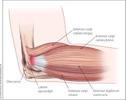 Evaluation of Elbow Pain in Adults - American Family Physician