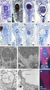 Liverworts are called liverworts because long ago the people who named them felt that the curious arrangement of cells on the surface of some liverworts was similar to the cell arrangement in actual. Mprkd Functions Are Required For Egg Differentiation In Liverworts Download Scientific Diagram