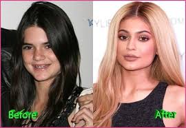 To revisit this article, visit my profile, thenview saved stories. Kylie Jenner Plastic Surgery Before And After Celebrity Plastic Plastic Surgery Kylie Jenner Plastic Surgery Plastic Surgery Celebrity Plastic Surgery