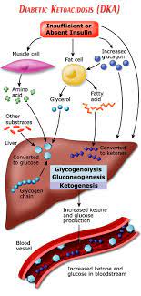 Pin By Najla Afifah On Nursing Diabetic Ketoacidosis Diabetes Education Nursing Information