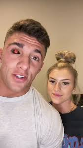 eye almost got it 😮