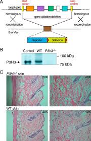283.83(1m)(f) (f) except as provided in par. P3h3 Null And Sc65 Null Mice Phenocopy The Collagen Lysine Under Hydroxylation And Cross Linking Abnormality Of Ehlers Danlos Syndrome Type Via Journal Of Biological Chemistry