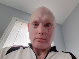 Fundraiser by Michael Targouski : Stand with Michael: 10 Months in Hospital