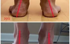 Pin On Healthy Fit