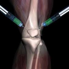 Image result for Knee Injection