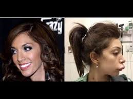 صور مشاهير أعلنوا ندمهم على عمليات تجميل شوهت أشكالهم youtube youtube the originals music