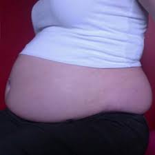 Unter den berufstätigen sei dicksein so stark verbreitet. Bin Ich Ubergewichtig Bilder Korper Figur Ubergewicht