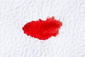 Keguguran dengan kata lain, meninggalnya embrio atau janin sebelum 20 minggu masa kehamilan. Ini 5 Tanda Keguguran Yang Perlu Anda Waspadai Selama Masa Kehamilan Beauty Journal