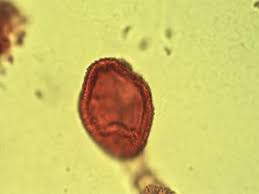 Image result for Pentarhopalopilia umbellulata