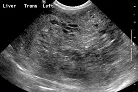 Benign liver lesions usually don't cause any symptoms. Imaging Essentials Small Animal Abdominal Ultrasonography