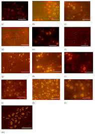 Processes Free Full Text Manipulation Of Culture Conditions Tool For Correlating Improving Lipid And Carotenoid Production By Rhodotorula Glutinis Html
