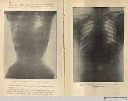 Did Corsets Harm Women S Health Books Health And History