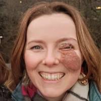 Very proud of the work that Changing Faces, UK continues to do for the  visible difference community and their (our) families. Donations this week  are doubled via matched funding -…