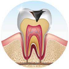 A tooth pain also tends to appear worse when one is already lying in bed. How To Sleep With A Toothache Help You Rest Sleep