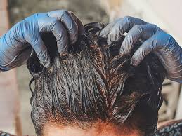 But the ingredients present in the dye can irritate your scalp and lead to an allergic reaction! Natural Hair Dyes 5 Of The Best